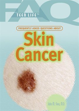 Cover image for Frequently Asked Questions About Skin Cancer