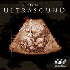 Cover image for Ultrasound