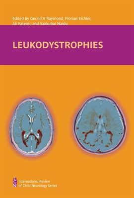 Cover image for Leukodystrophies