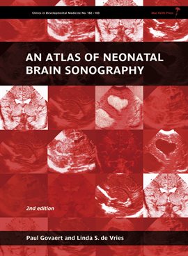 Cover image for An Atlas of Neonatal Brain Sonography, 2nd Edition