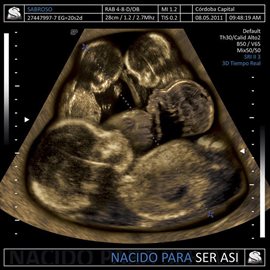 Cover image for Nacido para Ser Así